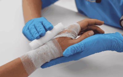 ¿Qué hacer en caso de quemaduras?